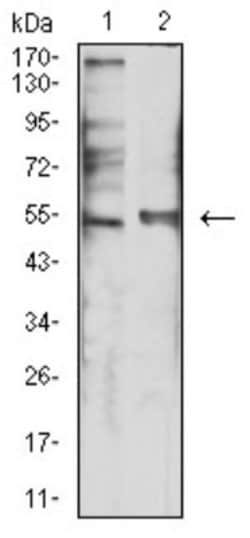 5-HT3B Antibody (2H9H5) - BSA Free, Novus Biologicals 0.1 ml; Unconjugated:Antibodies,